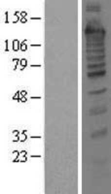 Western Blot: Treacher Collins syndrome protein Overexpression Lysate [NBL1-16785]