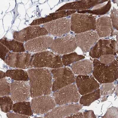 Immunohistochemistry-Paraffin: Triadin Antibody [NBP1-87417]