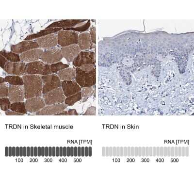 Immunohistochemistry-Paraffin: Triadin Antibody [NBP1-87417]