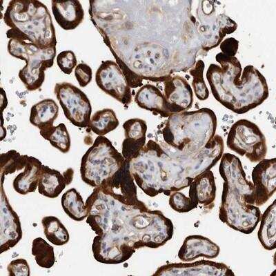 Immunohistochemistry-Paraffin: Trichohyalin Antibody [NBP1-80687]