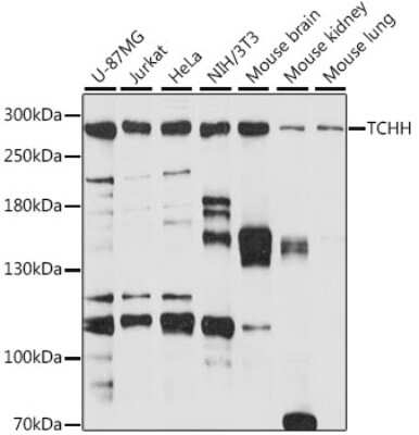 Western Blot: Trichohyalin AntibodyAzide and BSA Free [NBP2-93477]