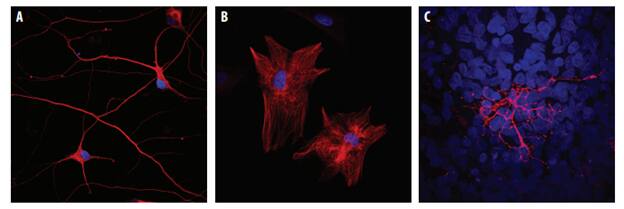 NUTEMPEROR Xenotransplantation ベアトップ