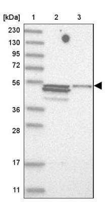 Western Blot: Trim11 Antibody [NBP1-88609]