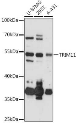 Western Blot: Trim11 AntibodyAzide and BSA Free [NBP2-94733]