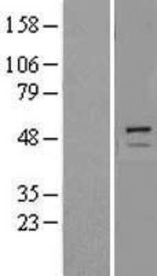 Western Blot: Trim11 Overexpression Lysate [NBL1-17275]
