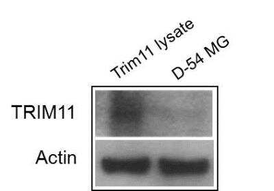 Western Blot: Trim11 Overexpression Lysate [NBL1-17275]