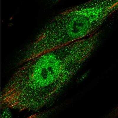 Immunocytochemistry/ Immunofluorescence: Trim22 Antibody [NBP1-81795]