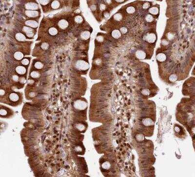 Immunohistochemistry-Paraffin: Trim22 Antibody [NBP1-81795]