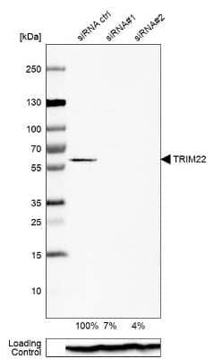 Western Blot: Trim22 Antibody [NBP1-81795]