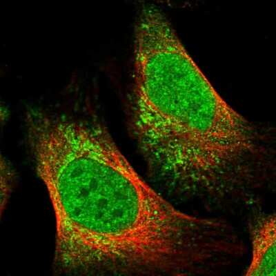 Immunocytochemistry/ Immunofluorescence: Trinucleotide Repeat Containing 18 Antibody [NBP2-30515]