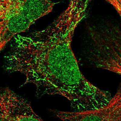 Immunocytochemistry/ Immunofluorescence: Trinucleotide Repeat Containing 18 Antibody [NBP2-30890]