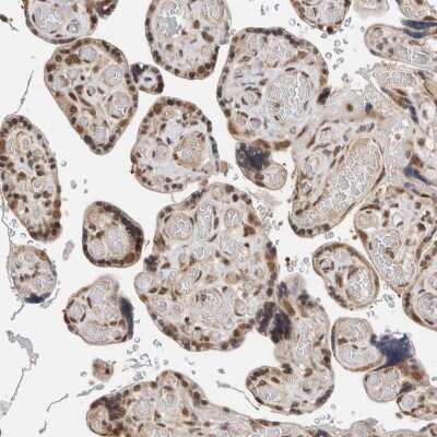 Immunohistochemistry-Paraffin: Trinucleotide Repeat Containing 18 Antibody [NBP2-30515]