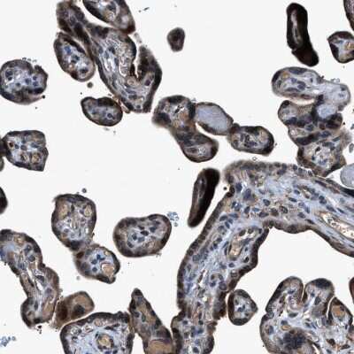 Immunohistochemistry-Paraffin: Trinucleotide Repeat Containing 18 Antibody [NBP2-30890]
