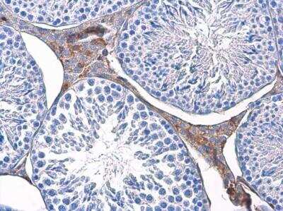 Immunohistochemistry-Paraffin: Triosephosphate isomerase Antibody (1111) [NBP2-43824]
