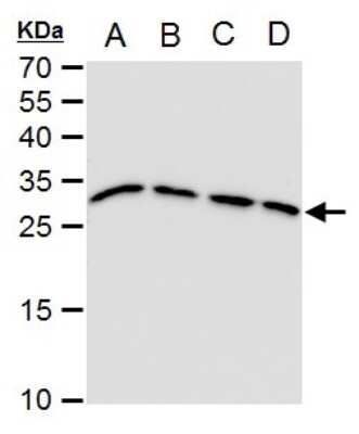 Western Blot: Triosephosphate isomerase Antibody (1111) [NBP2-43824]