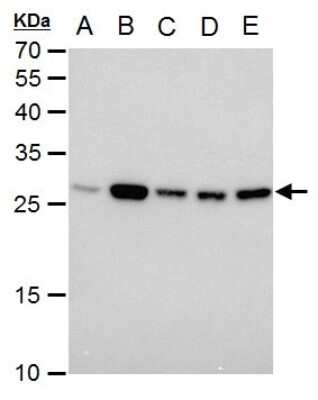 Western Blot: Triosephosphate isomerase Antibody (1111) [NBP2-43824]
