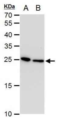 Western Blot: Triosephosphate isomerase Antibody (1111) [NBP2-43824]