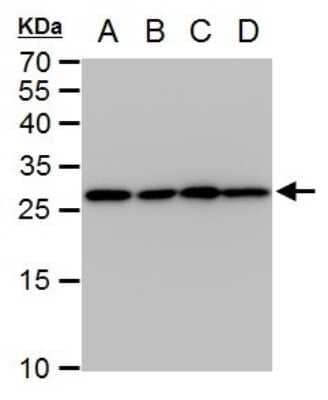 Western Blot: Triosephosphate isomerase Antibody (181) [NBP2-43761]