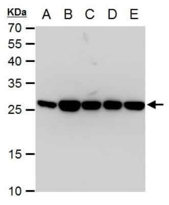 Western Blot: Triosephosphate isomerase Antibody (181) [NBP2-43761]