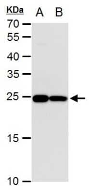 Western Blot: Triosephosphate isomerase Antibody (181) [NBP2-43761]