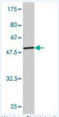 Western Blot: Triosephosphate isomerase Antibody (1D10-2E2) [H00007167-M01]