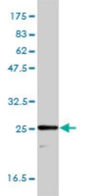 Western Blot: Triosephosphate isomerase Antibody (1D10-2E2) [H00007167-M01]