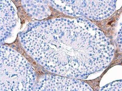 Immunohistochemistry-Paraffin: Triosephosphate isomerase Antibody (3711) [NBP2-43825]