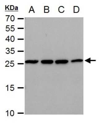 Western Blot: Triosephosphate isomerase Antibody (3711) [NBP2-43825]