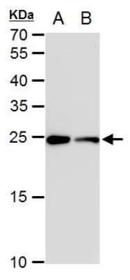 Western Blot: Triosephosphate isomerase Antibody (3711) [NBP2-43825]