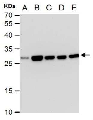 Western Blot: Triosephosphate isomerase Antibody (3711) [NBP2-43825]