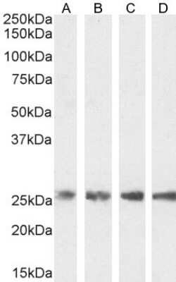 Western Blot: Triosephosphate isomerase Antibody [NB300-994]