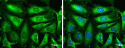 Immunocytochemistry/ Immunofluorescence: Triosephosphate isomerase Antibody [NBP1-31470]