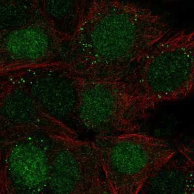 Immunocytochemistry/ Immunofluorescence: Triosephosphate isomerase Antibody [NBP2-56753]