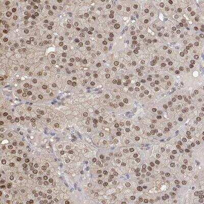 Immunohistochemistry: Triosephosphate isomerase Antibody [NBP2-56753]