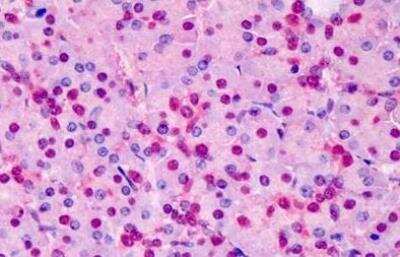 Immunohistochemistry-Paraffin: Triosephosphate isomerase Antibody [NB300-994]