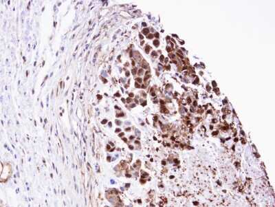 Immunohistochemistry-Paraffin: Triosephosphate isomerase Antibody [NBP1-31470]