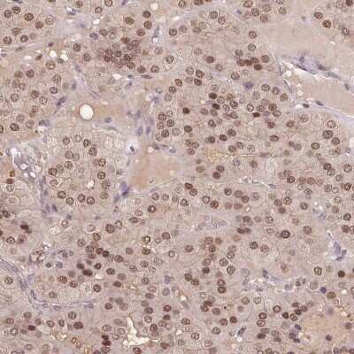 Immunohistochemistry-Paraffin: Triosephosphate isomerase Antibody [NBP2-58150]