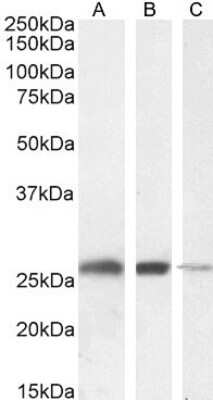 Western Blot: Triosephosphate isomerase Antibody [NB300-994]