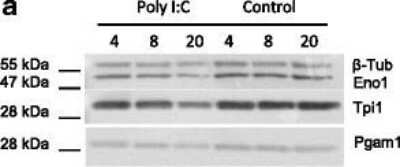 Western Blot: Triosephosphate isomerase Antibody [NBP1-31470]