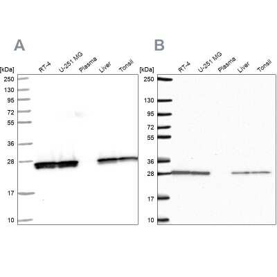 Western Blot: Triosephosphate isomerase Antibody [NBP2-56753]