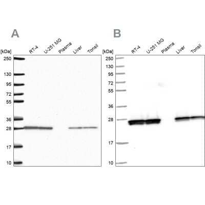 Western Blot: Triosephosphate isomerase Antibody [NBP2-58150]