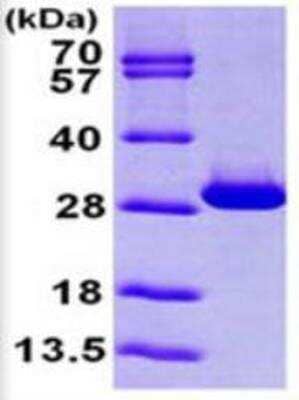 SDS-PAGE: Recombinant Human Triosephosphate isomerase His Protein [NBP1-49451]