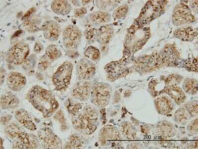 Immunohistochemistry-Paraffin: Tripeptidyl-Peptidase I/TPP1 Antibody (3B1) [H00001200-M01]