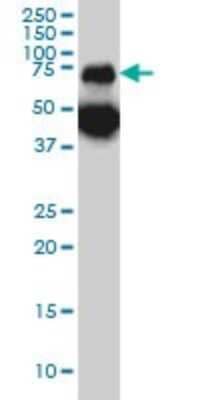 Western Blot: Tripeptidyl-Peptidase I/TPP1 Antibody (3B1) [H00001200-M01]