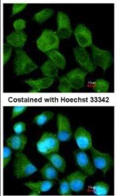 Immunocytochemistry/ Immunofluorescence: Tripeptidyl-Peptidase I/TPP1 Antibody [NBP1-31758]