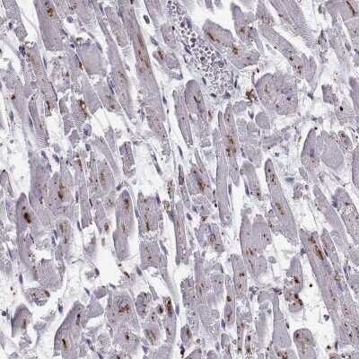 Immunohistochemistry: Tripeptidyl-Peptidase I/TPP1 Antibody [NBP2-48820]