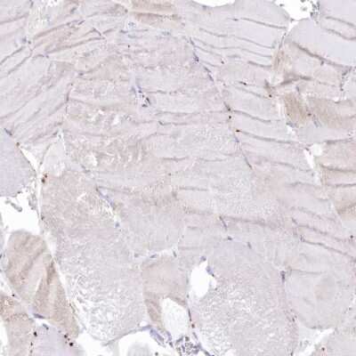 Immunohistochemistry-Paraffin: Tripeptidyl-Peptidase I/TPP1 Antibody [NBP1-85561]