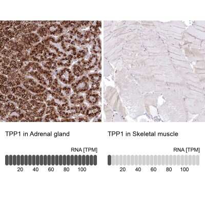 Immunohistochemistry-Paraffin: Tripeptidyl-Peptidase I/TPP1 Antibody [NBP1-85561]