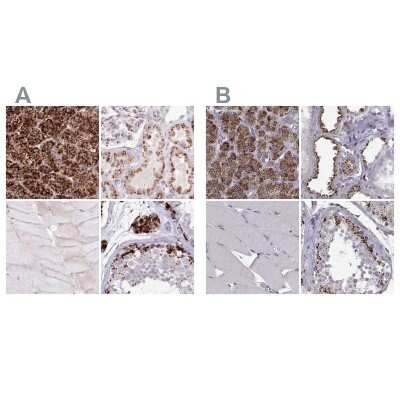 Immunohistochemistry-Paraffin: Tripeptidyl-Peptidase I/TPP1 Antibody [NBP1-85561]
