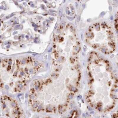 Immunohistochemistry-Paraffin: Tripeptidyl-Peptidase I/TPP1 Antibody [NBP1-85561]